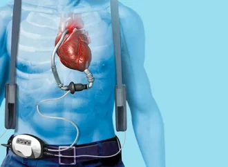 Strengthening Confidence Through Structured Vascular Support