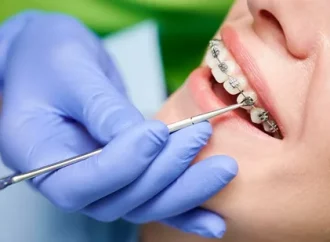 Emergency Dentist & Orthodontics in Newton Abbot