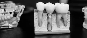 dental care
