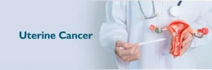 Uterine cancer treatment