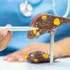 Liver Nutritionist in Mumbai: Fatty Liver, Hepatitis, and Liver Care