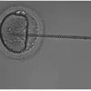 ICSI Procedure: How Embryologists Assess Oocyte Stability