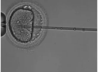 ICSI Procedure: How Embryologists Assess Oocyte Stability