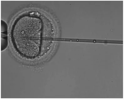 ICSI Procedure: How Embryologists Assess Oocyte Stability