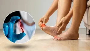 Stem Cell Therapy