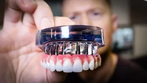Full Mouth Rehabilitation